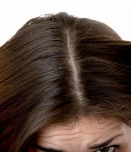 Tạm biệt tóc bết nhờn, chào đón mái tóc khỏe đẹp với các mẹo trị nhờn da đầu tại nhà với MAI NGUYÊN HAIR SALON | SALON TÓC ĐẸP GÒ VẤP | LÀM TÓC ĐẸP GÒ VẤP